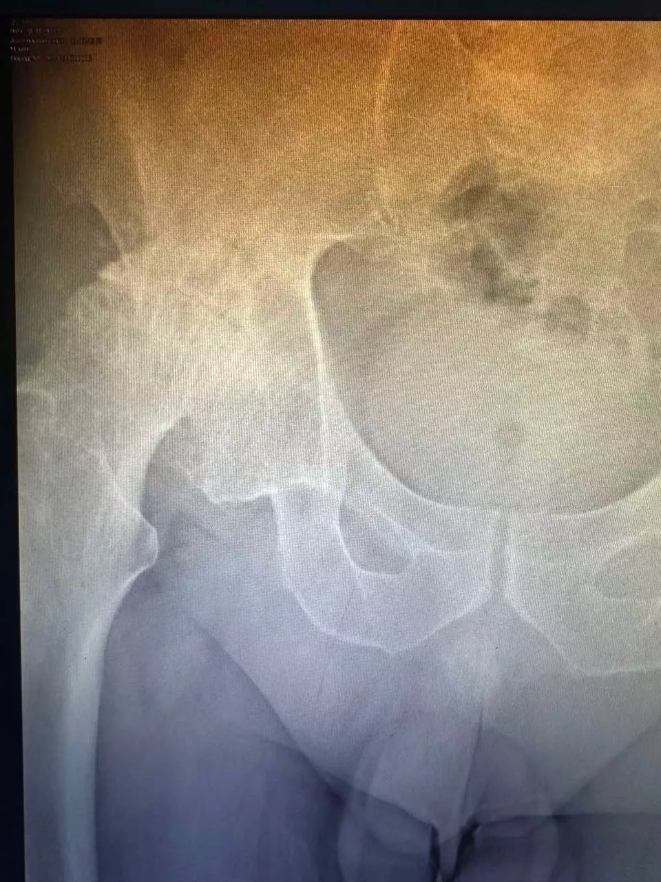 Пацієнт №2 - До 