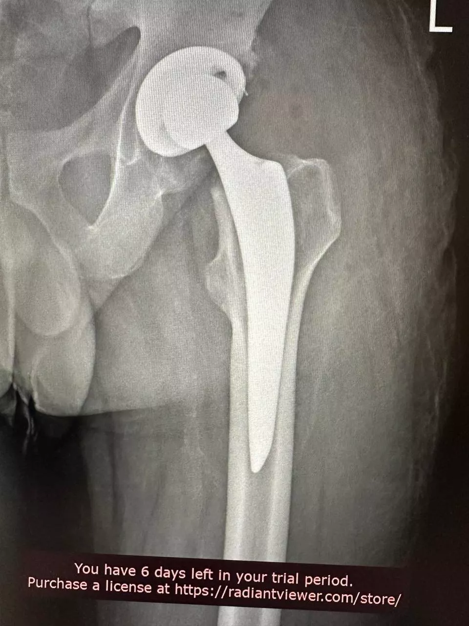 Пацієнт №4 - Після