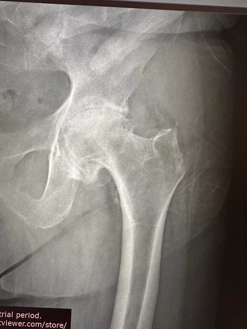 Пацієнт №5 - До 