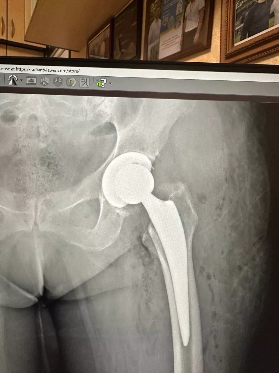 Пацієнт №5 - Після